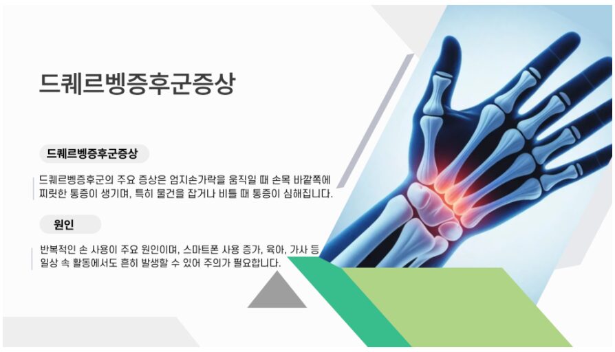 드퀘르뱅증후군_두팔로정형외과