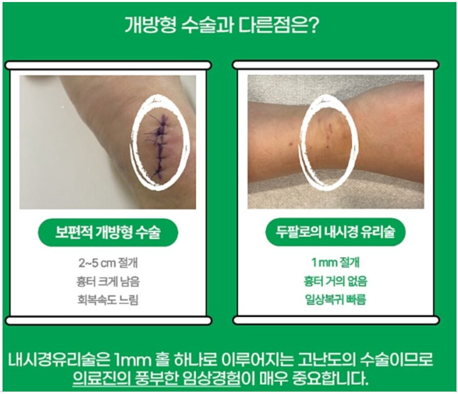 마곡동정형외과 손목건초염 원인