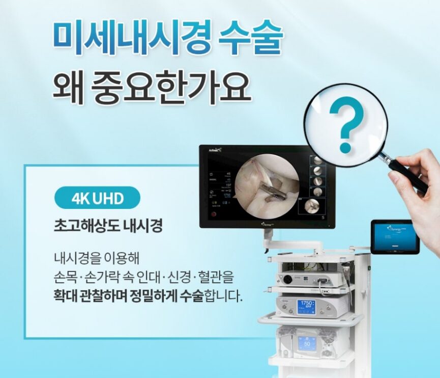 손목터널증후군