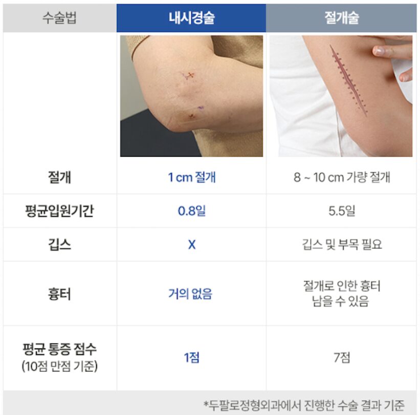 팔꿈치통증