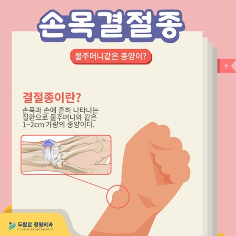 발산역정형외과 손목 결절종 수술해야 할까? 증상과 치료 기준 완벽 정리