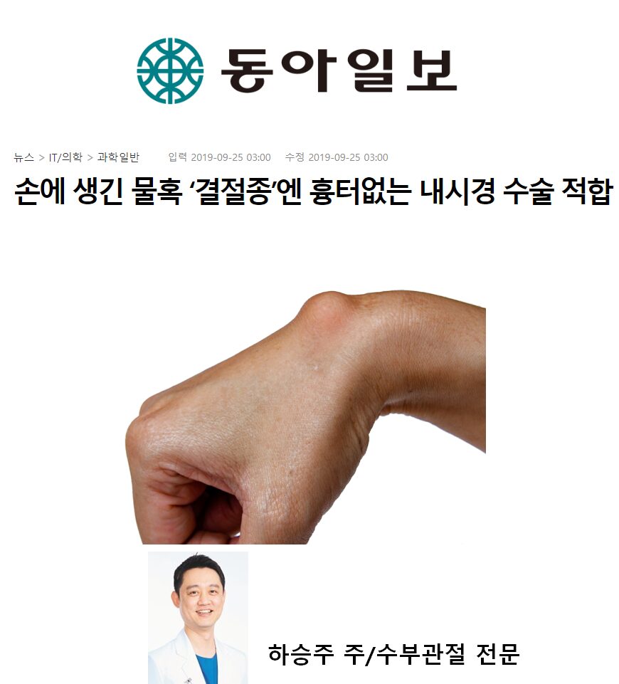 손목결절종수술 병원은 내시경 원스톱 수부정형외과로