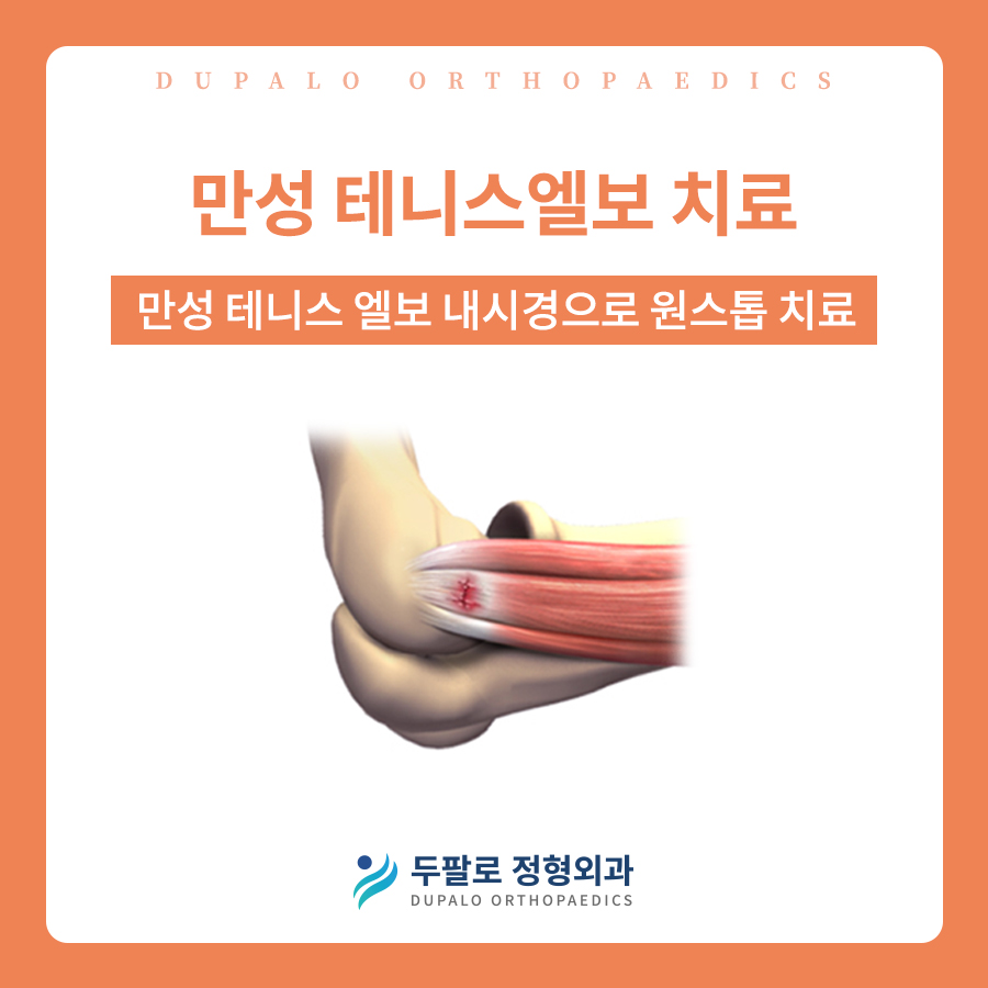 테니스엘보 수술은 입원·흉터·기브스 필요 없습니다