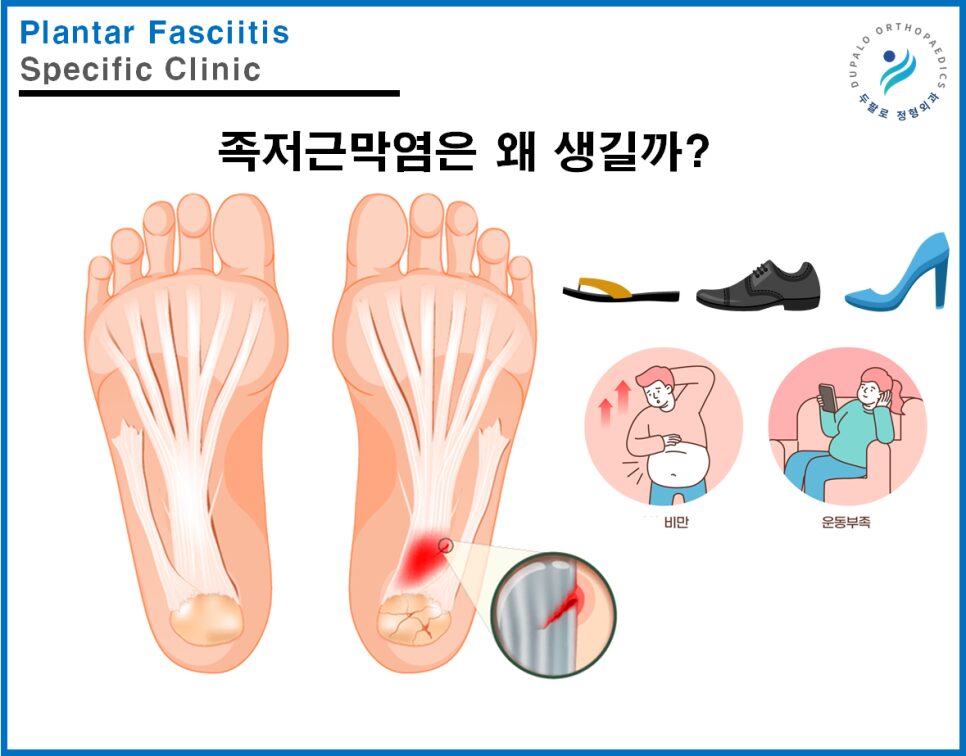 발산역 발바닥통증 족저근막염 치료, 세포재생 시술이 도움이 될까?