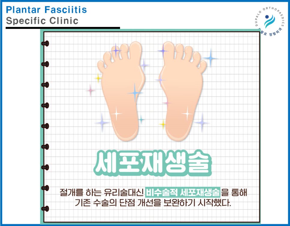 발산역 발바닥통증 족저근막염 치료, 세포재생 시술이 도움이 될까?