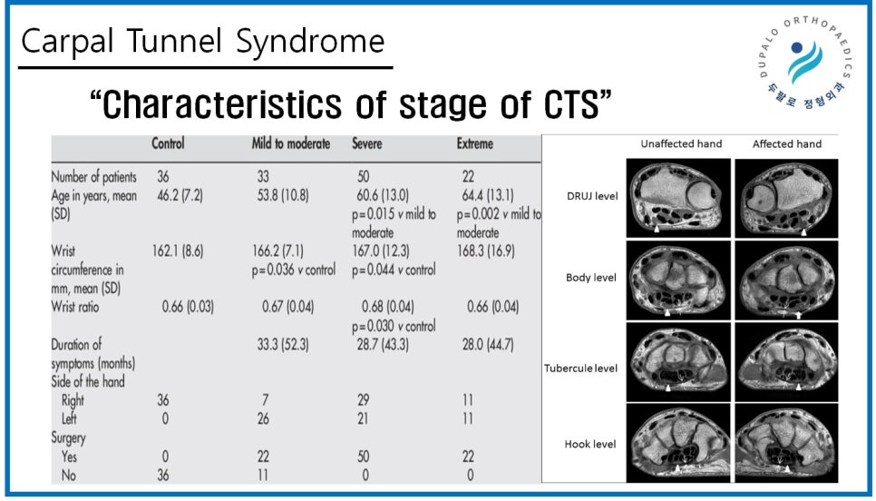 손목터널증후군 수술방법, 내시경과 절개의 회복부담 차이는 어느 정도일까?