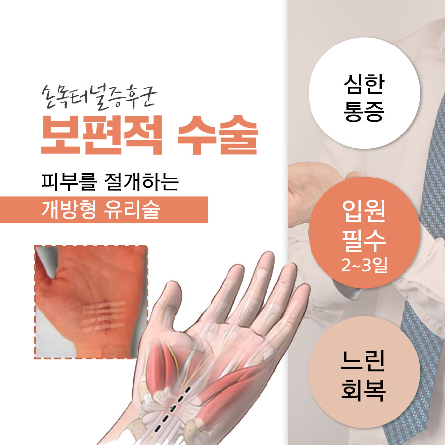 손목터널증후군 수술방법, 내시경과 절개의 회복부담 차이는 어느 정도일까?