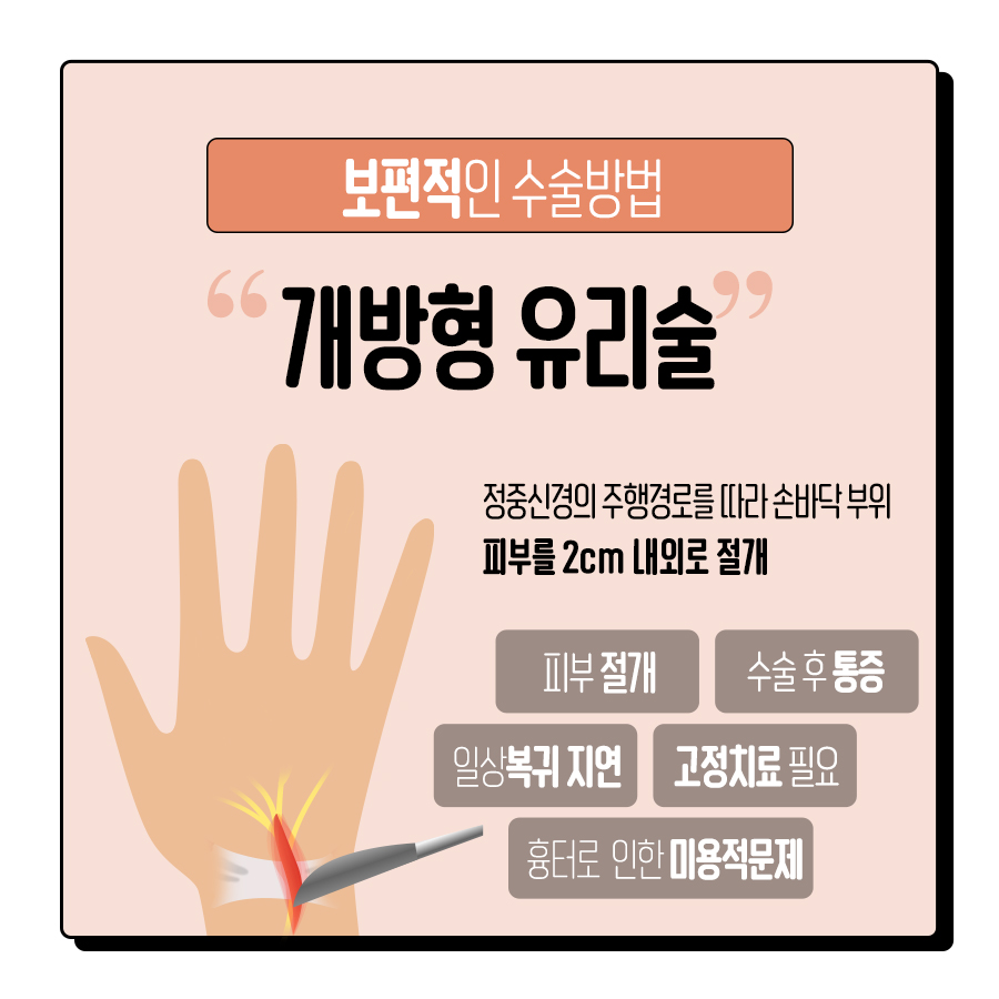 손목터널증후군 주사, 파스는 효과가 없는 이유?!