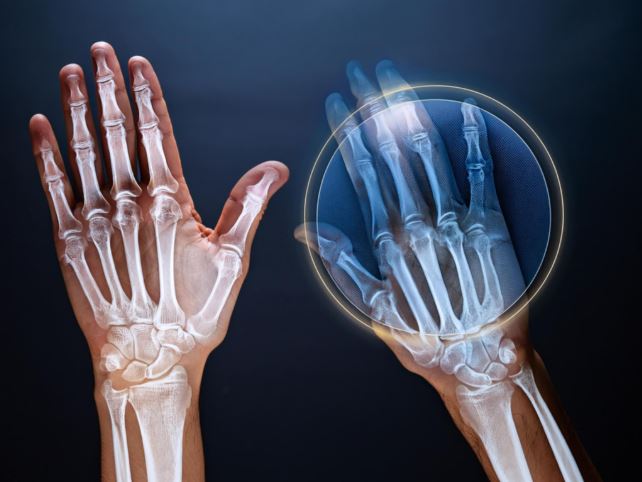 가운데손가락 통증 딱딱 소리 원인과 치료 방법