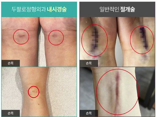 마곡동정형외과 검지손가락 통증 회복보다 후회가 먼저입니다