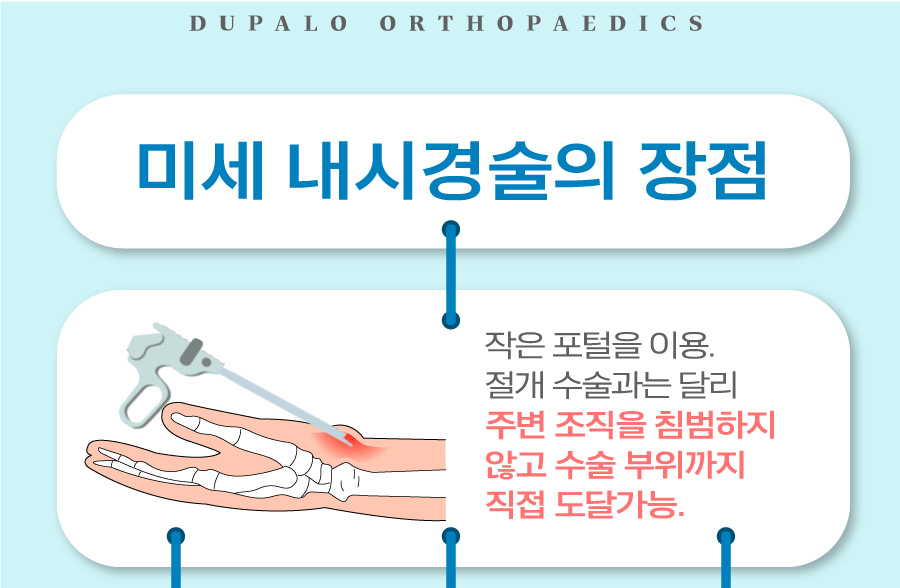 손목터널증후군 진단부터 내시경유리술까지