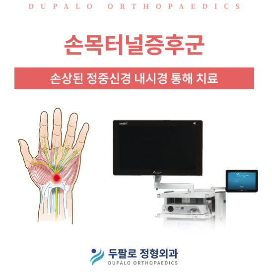 손목터널증후군 진단부터 내시경유리술까지