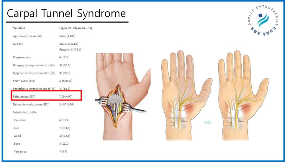 손목터널증후군 치료, 수술 비중이 높은 이유와 내시경 유리술 치료 방법